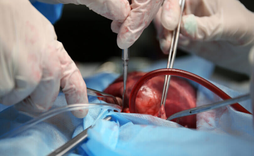 Featured Image Featured Image