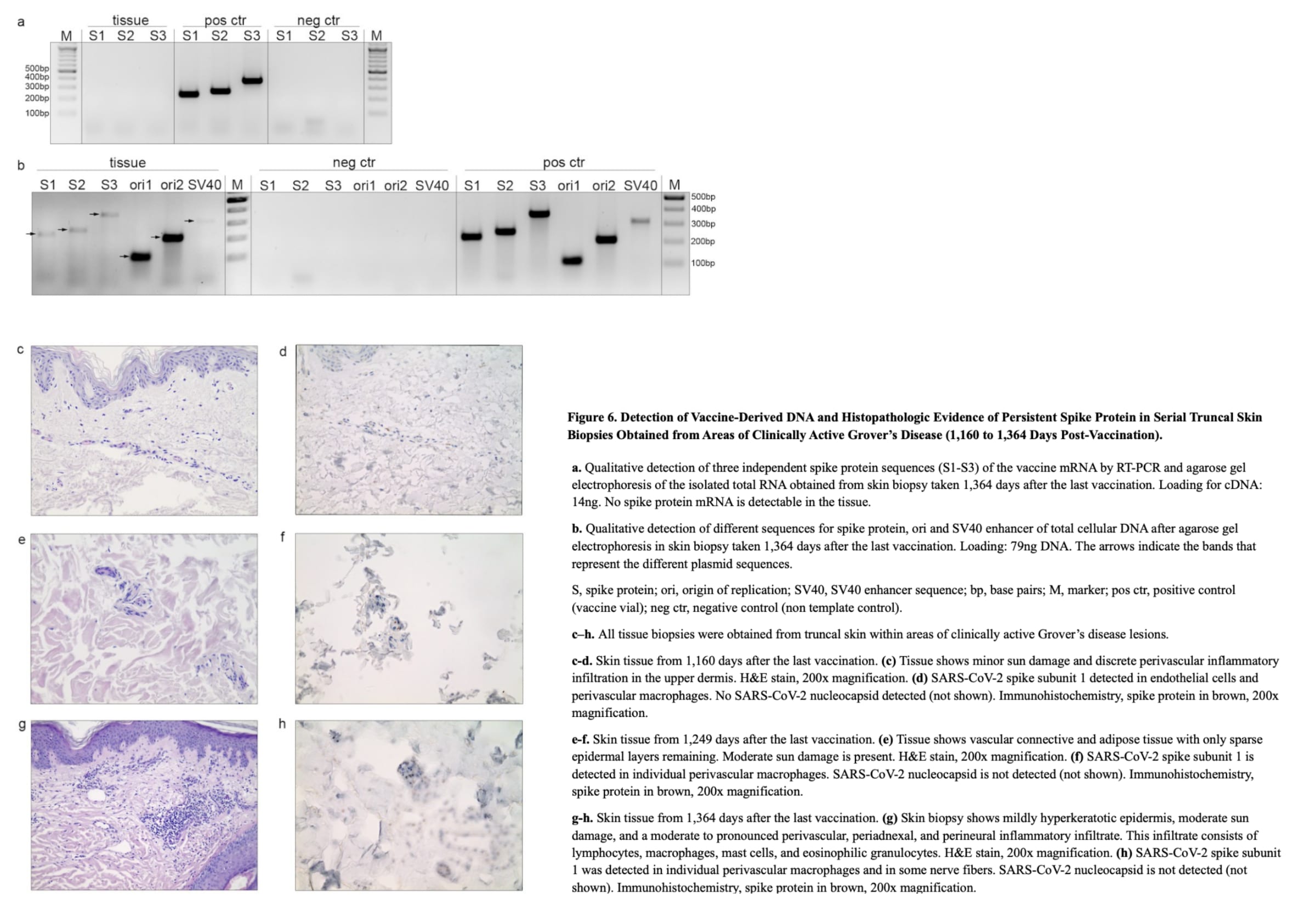 Impfstoff-mRNA, Plasmid-DNA und Spike-Protein können mehr als 3,5 Jahre nach der COVID-19-Impfung im Menschen verbleiben- 6