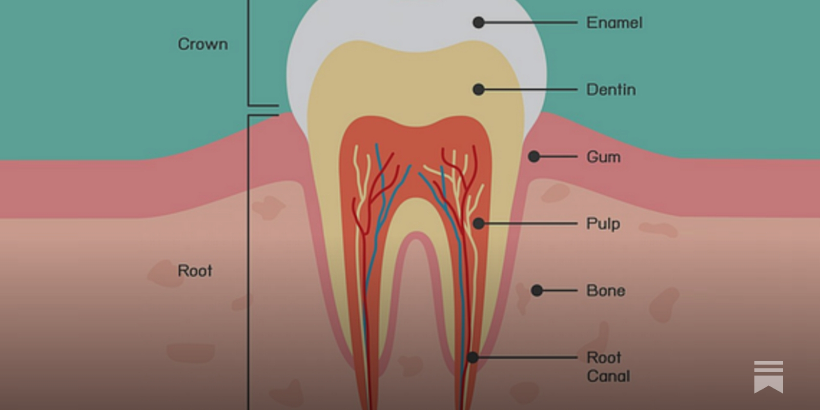A genetically modified bacterium that outcompetes bacteria causing tooth decay A genetically modified bacterium that outcompetes bacteria causing tooth decay