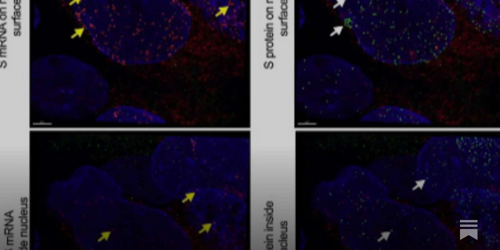 BRCA1 - Wikipedia