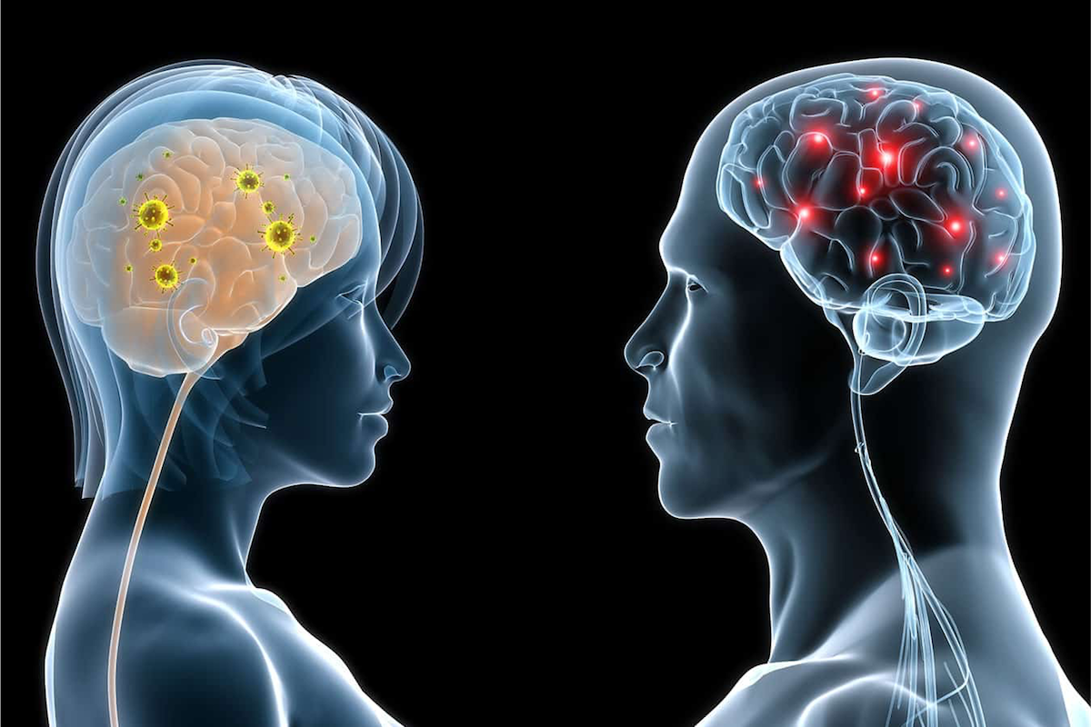 Brain 89. Мозг мужчины и мозг женщины. Мужской и женский мозг. Женские мозги. Фото мозга женщины.