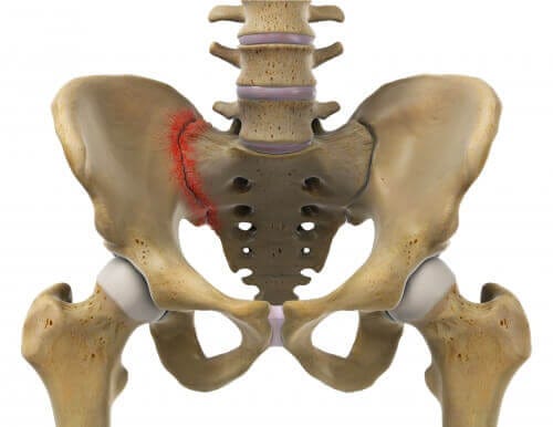 Symphysis Pubis Pain aka “Lightning Crotch” or Pelvic Pain During