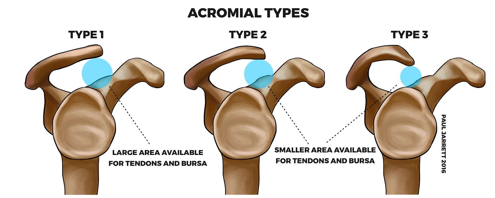 Tall Man Training - Strategies for 6ft+ Lifters