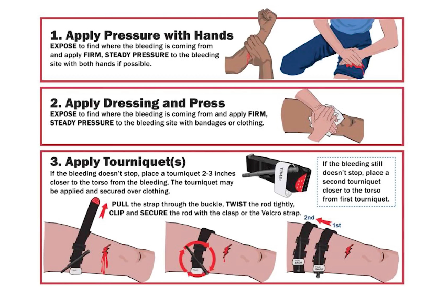 How to stop Bleeding first Aid.
