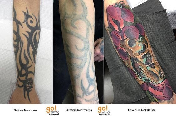 FADE OUT TATTOO REMOVAL - 61470 S Hwy 97, Bend, Oregon - Tattoo Removal -  Yelp - Phone Number