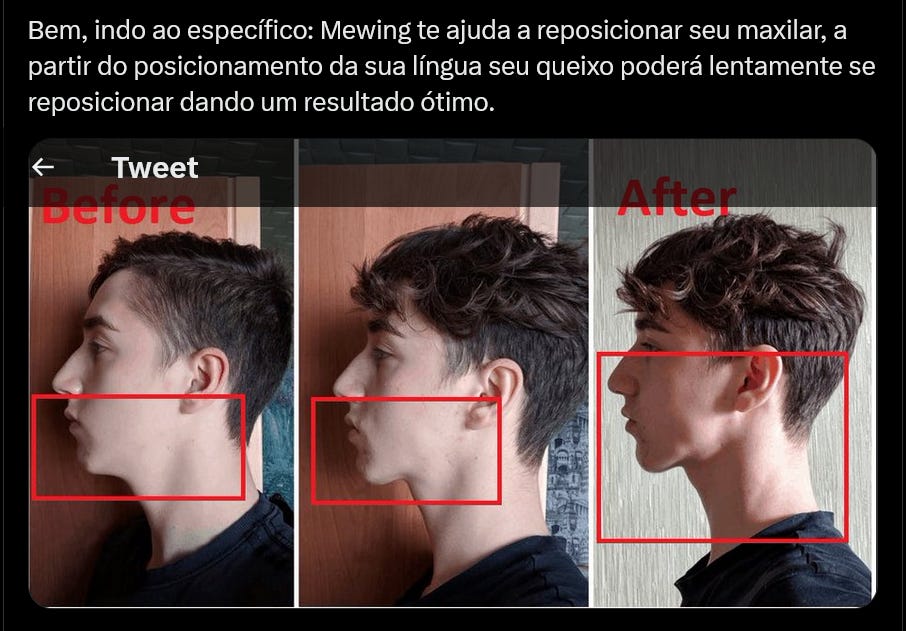 Mewing Brasil ® – A sua língua tem poder