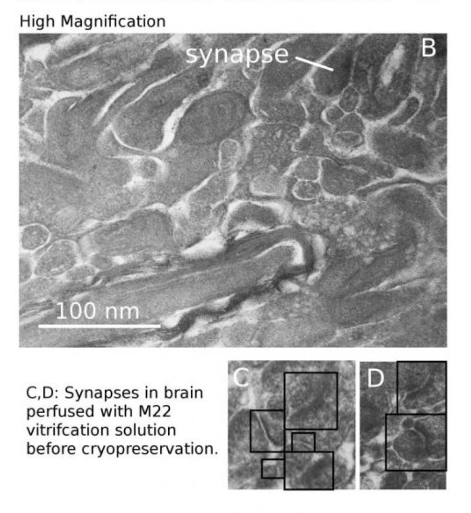 A high magnification image of synapse obtained by electron microscopy