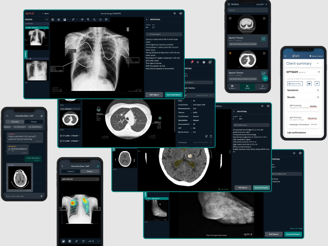 Trends in AI-Driven Diagnostics in Digital Health: Revolutionary Advances