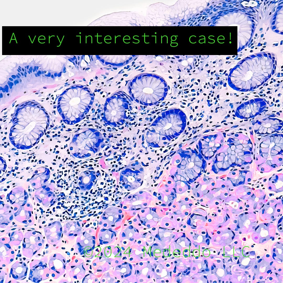 The Value of a Second, or 32nd, Medical Opinion