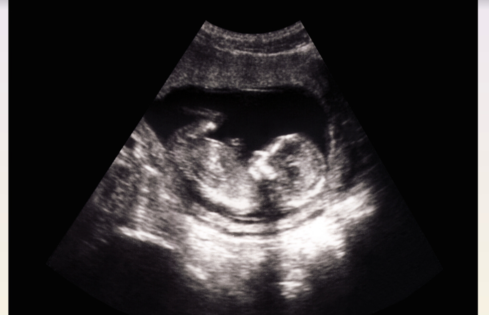 Babies Who Accept Being Aborted and Other Religious Claims