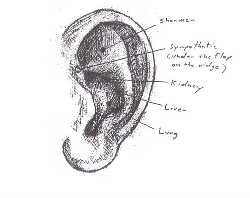 How These Tiny DIY Ear Seeds Helped Me Sleep Like a Baby for the First