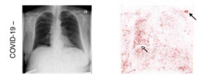Explainable AI : Understanding Saliency Maps