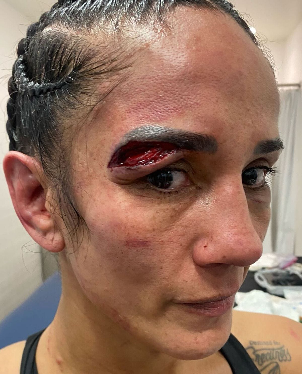 Amanda Serrano loses boxing contest after repeated head butts cause bad