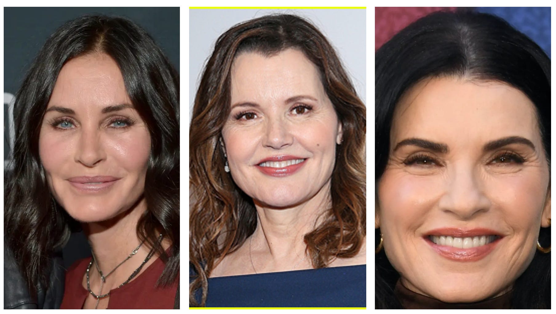Julianna margulies plastic surgery