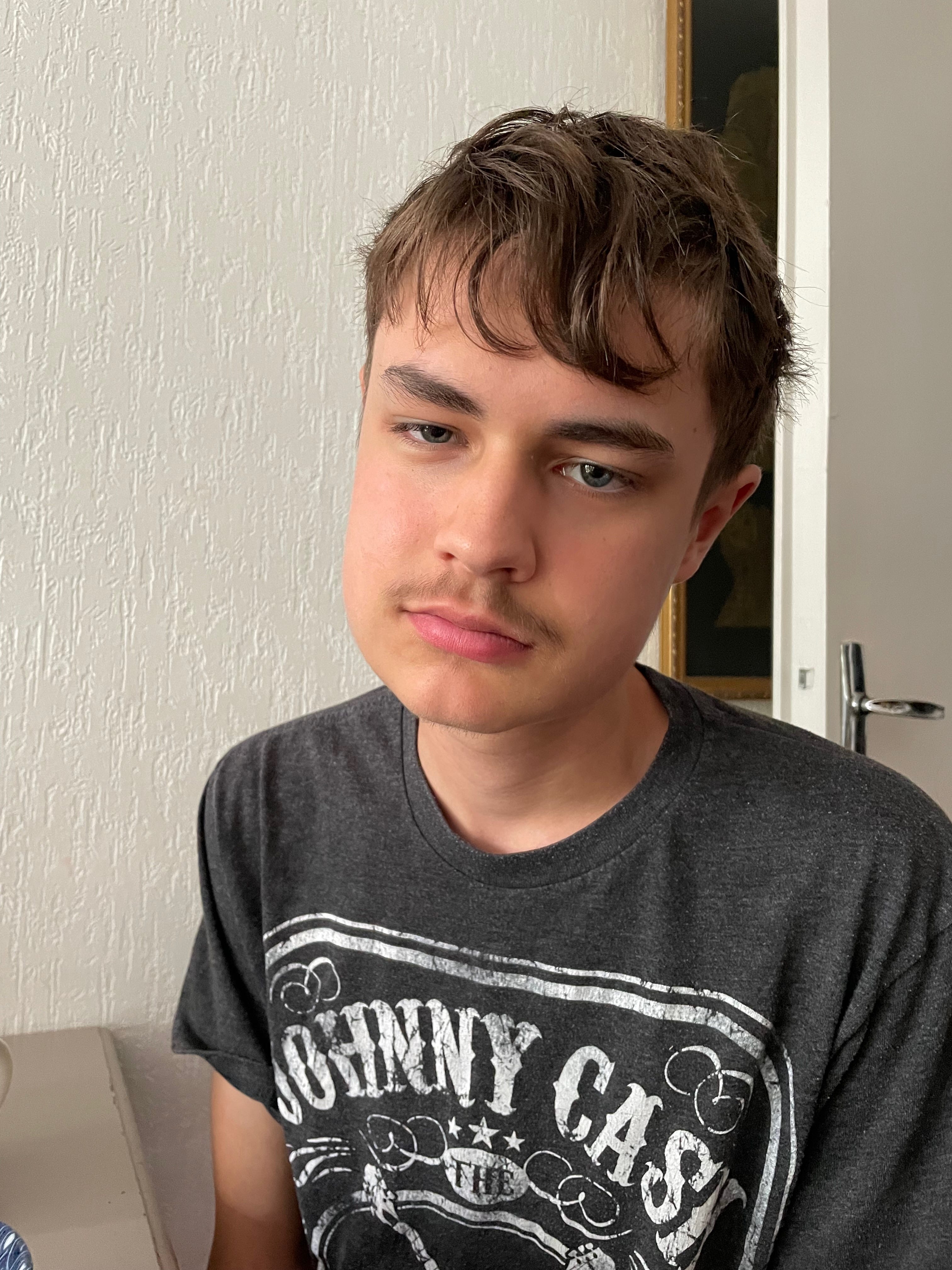 aftermath of getting wisdom teeth out