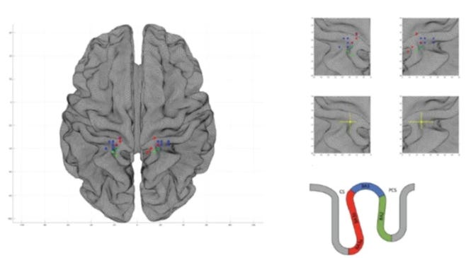 Neuroscience Reveals The Parts Of The Brain Responsible For Sexual Arousal And Orgasm 2485