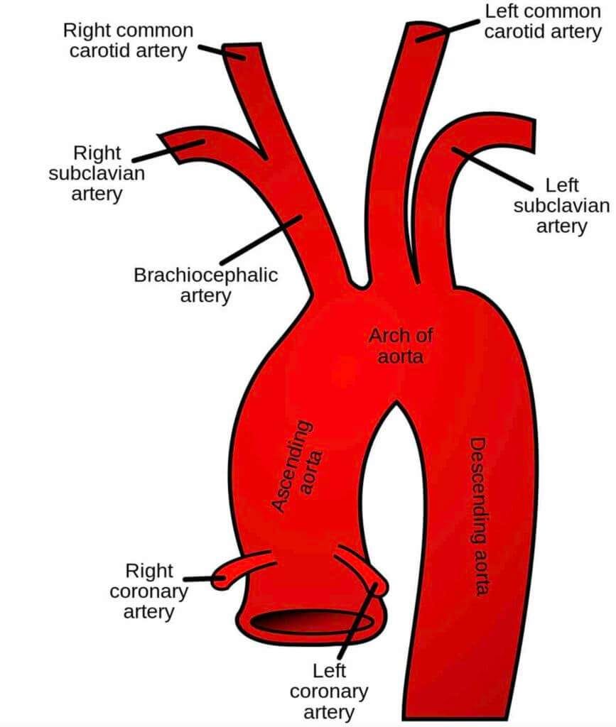 Is My Ascending Aorta Truly Enlarged or Enlarging?