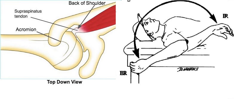 Internal impingement top