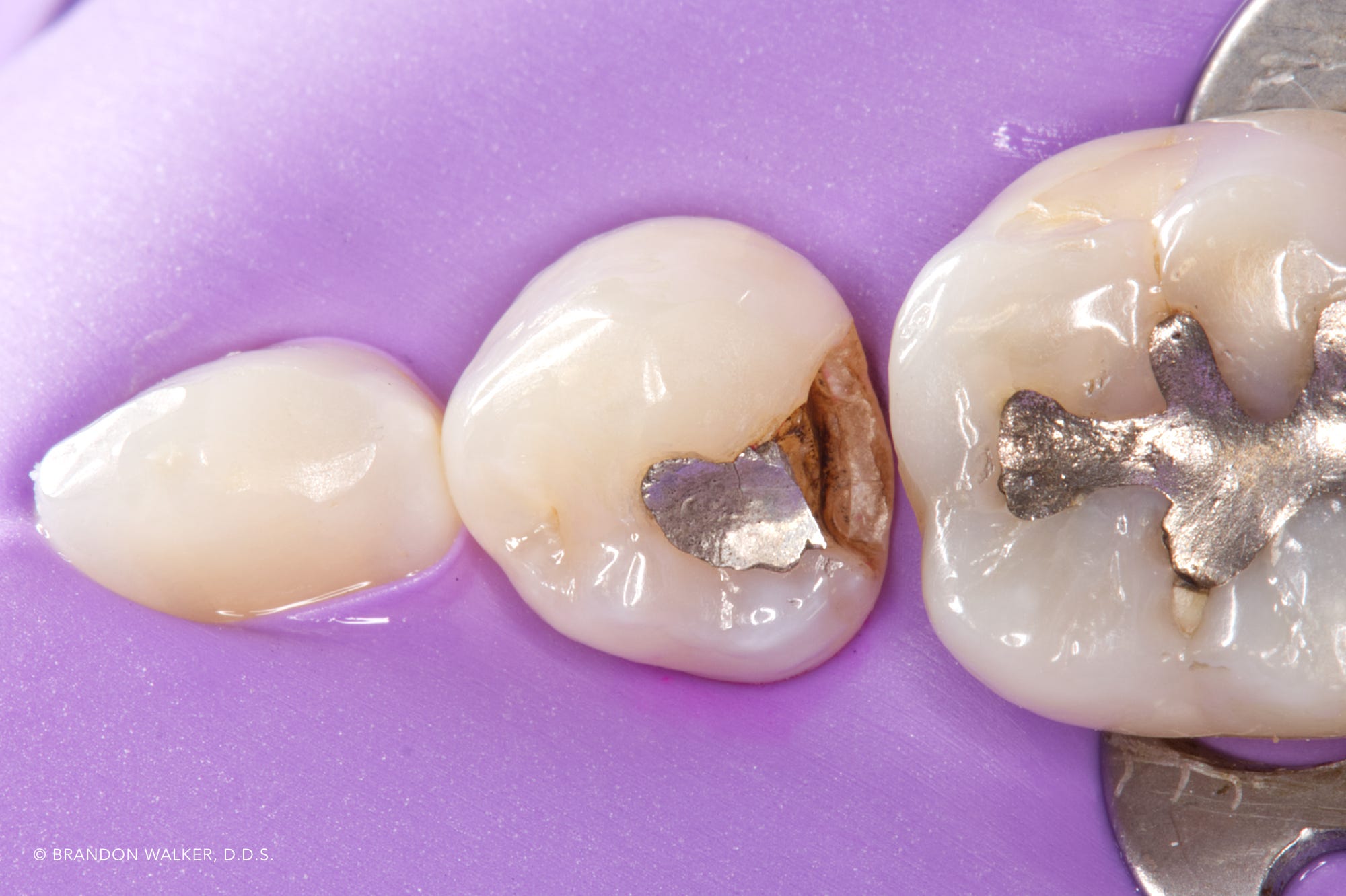 Practical Biomimetic Restorative Dentistry Brandon Walker, D.D.S