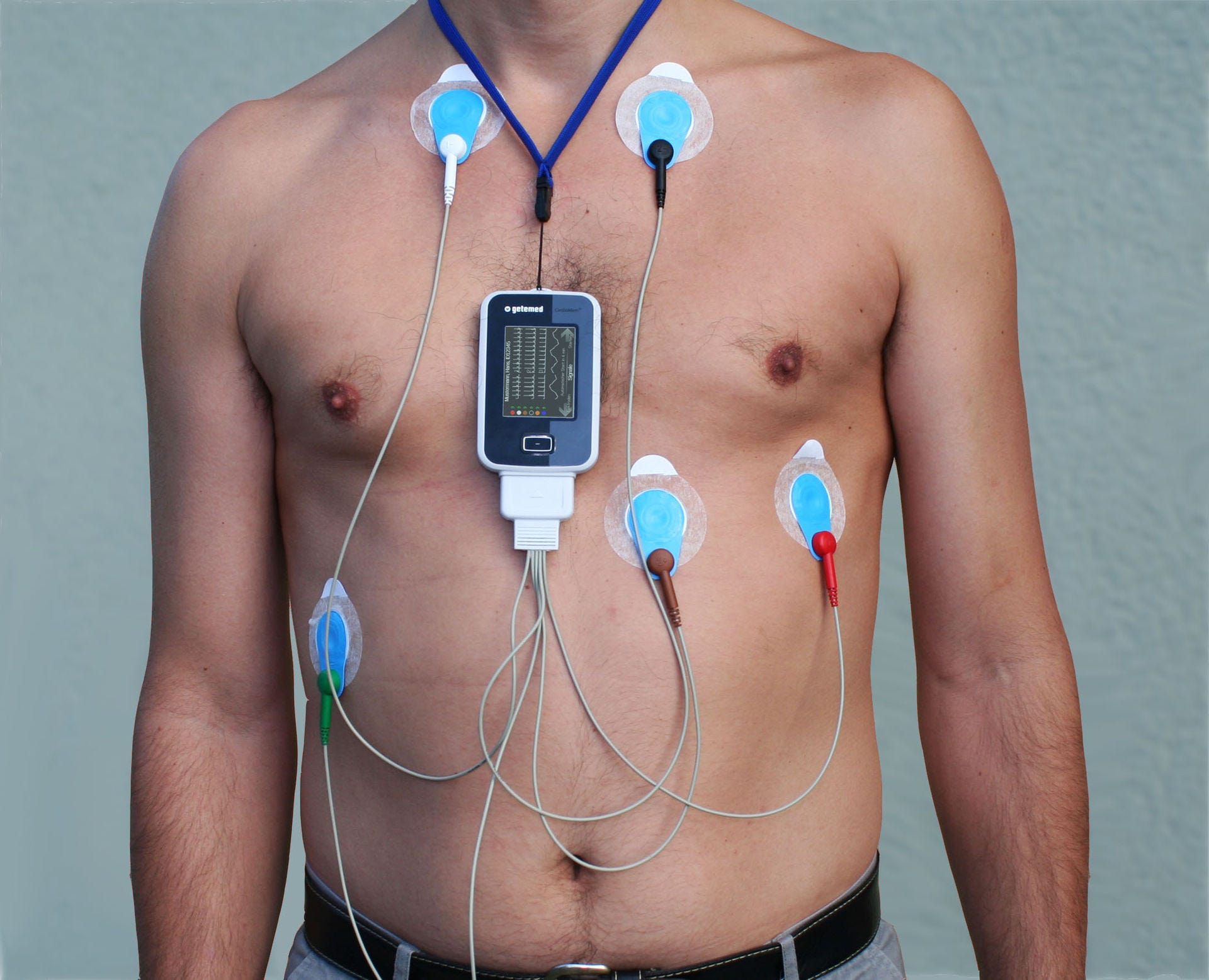 Holter monitor store apple watch