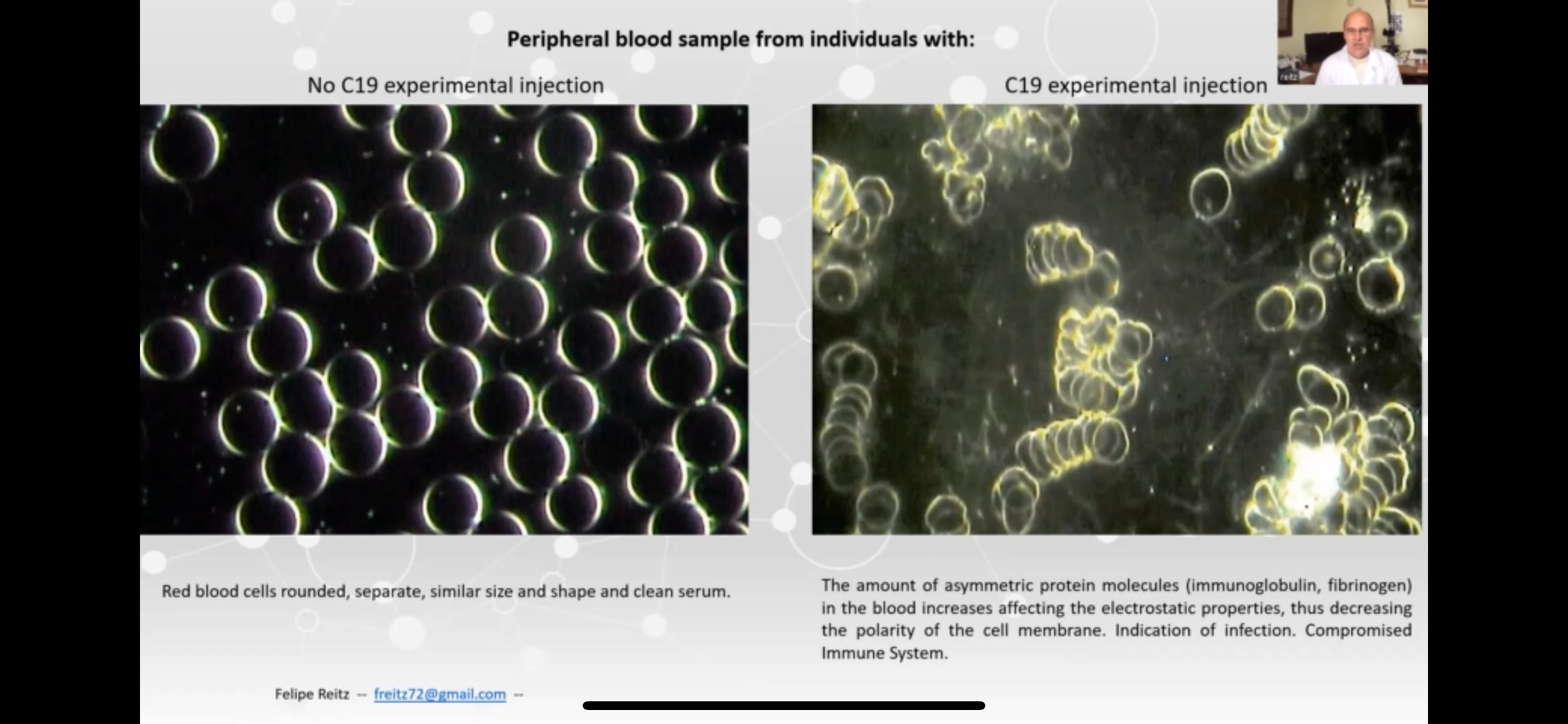 Computerized Thermographic Imaging and Live Blood Analysis Post C19 ...