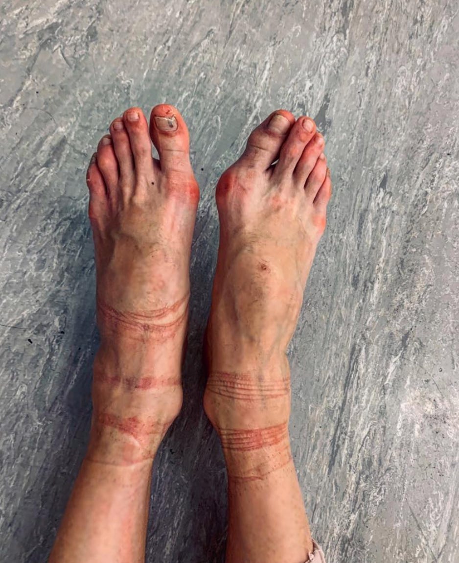 Dancers feet new arrivals after pointe