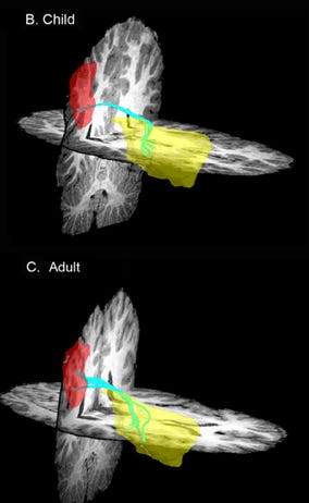 Uncorrelated functional and structural connectivity during insula and ...