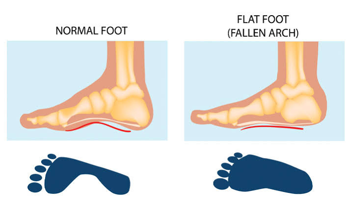Flat 2024 footed people