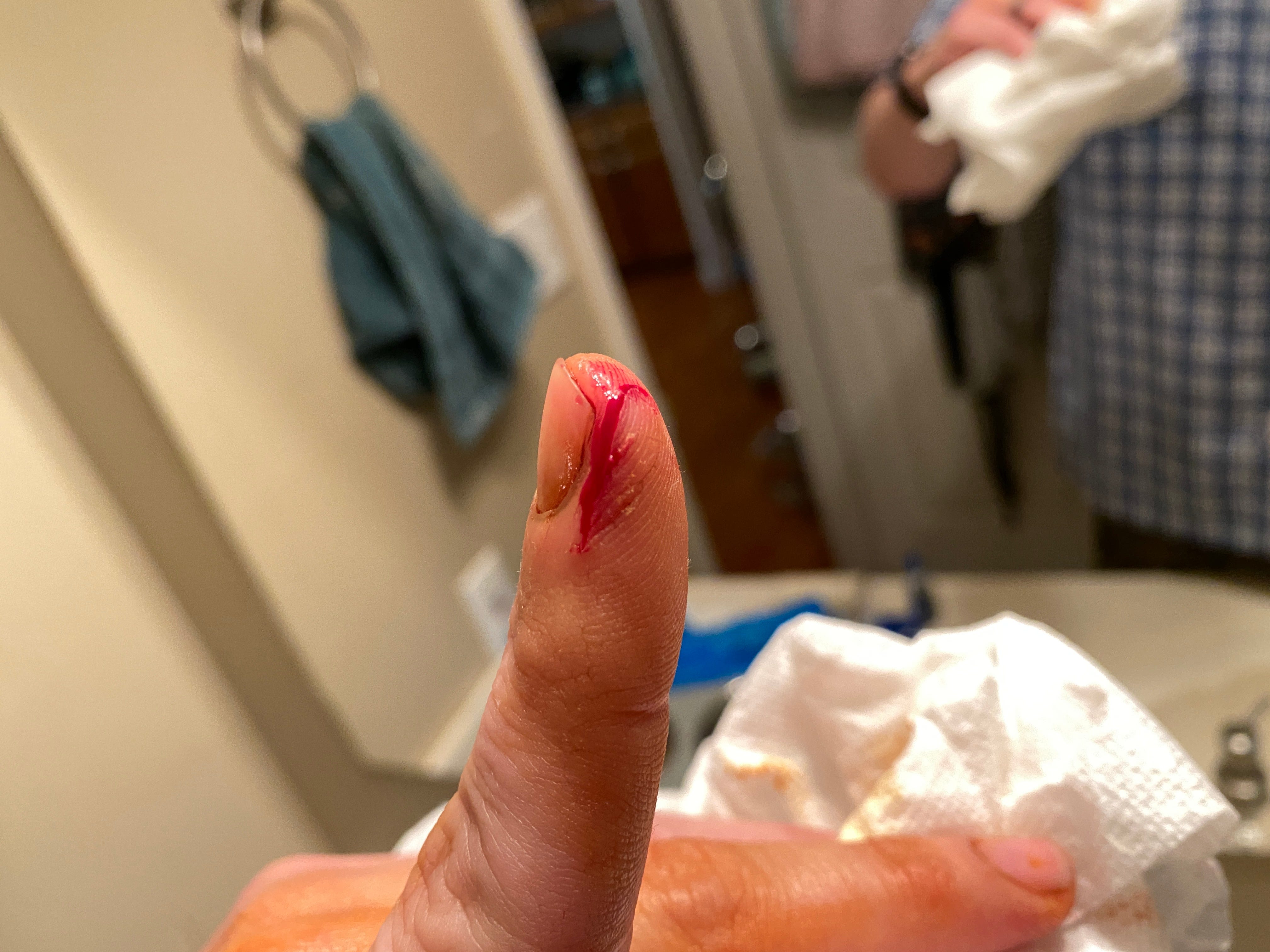 Super glue shop cut