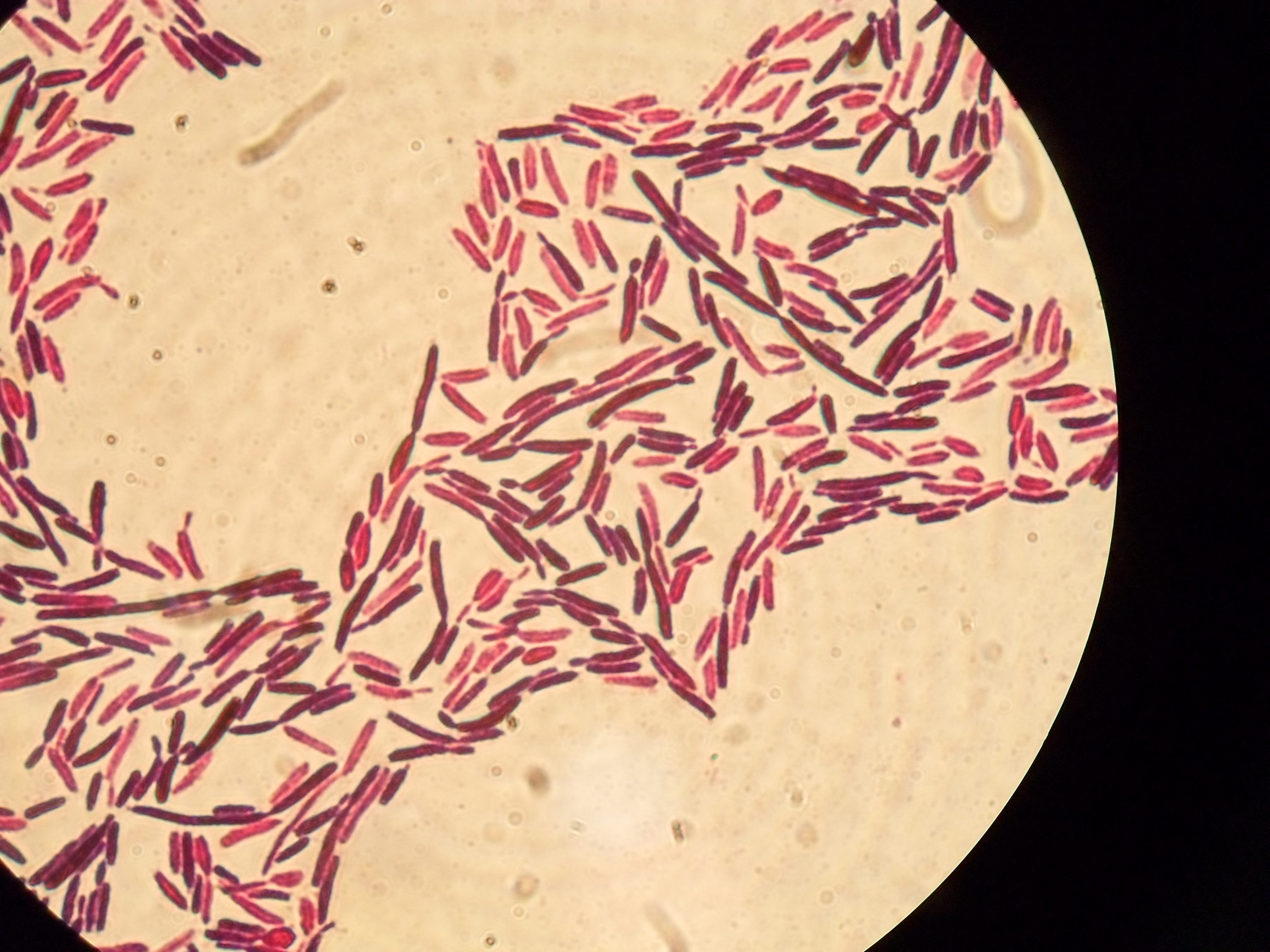 Fungus Alert World Health Organization releases fungal priority