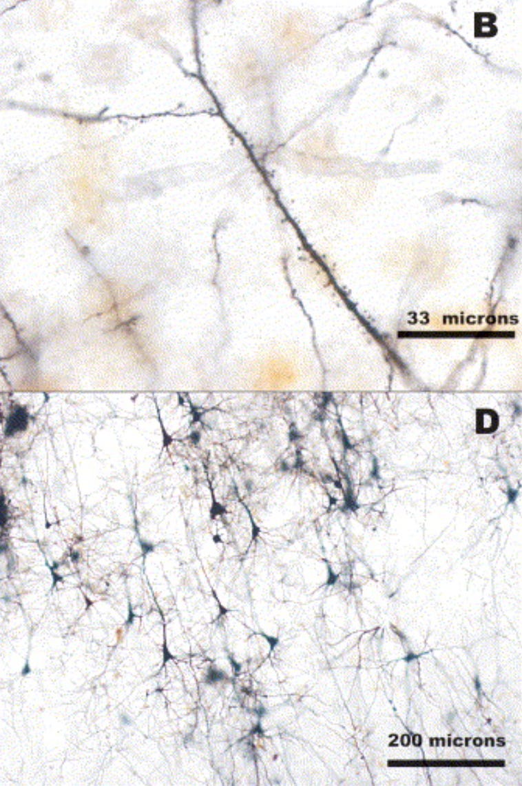Four approaches for longterm fixationbased brain banking