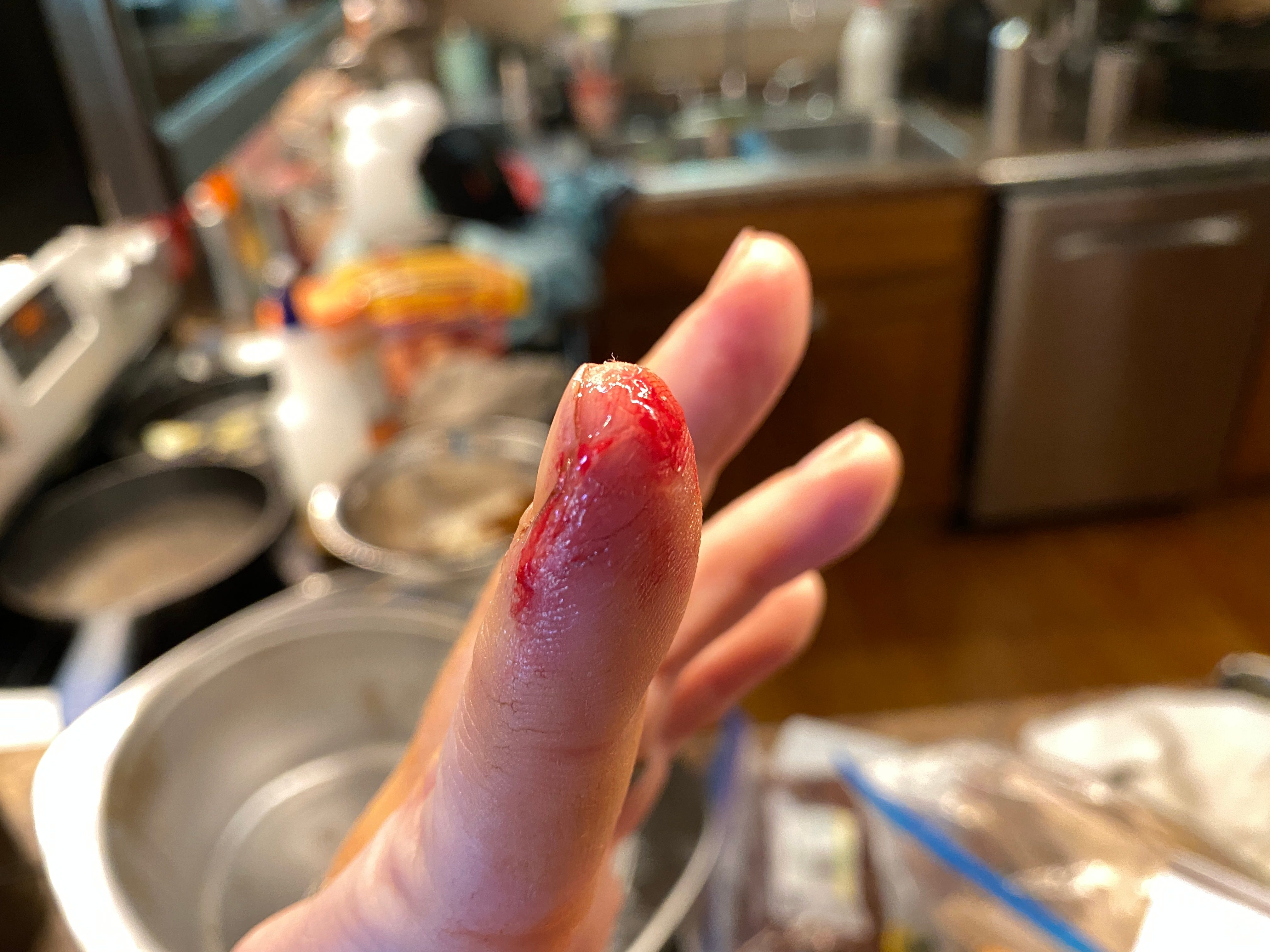 Super sales glue wounds