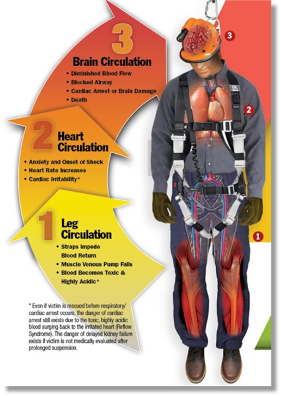 Suspension Trauma by Max Fuentes