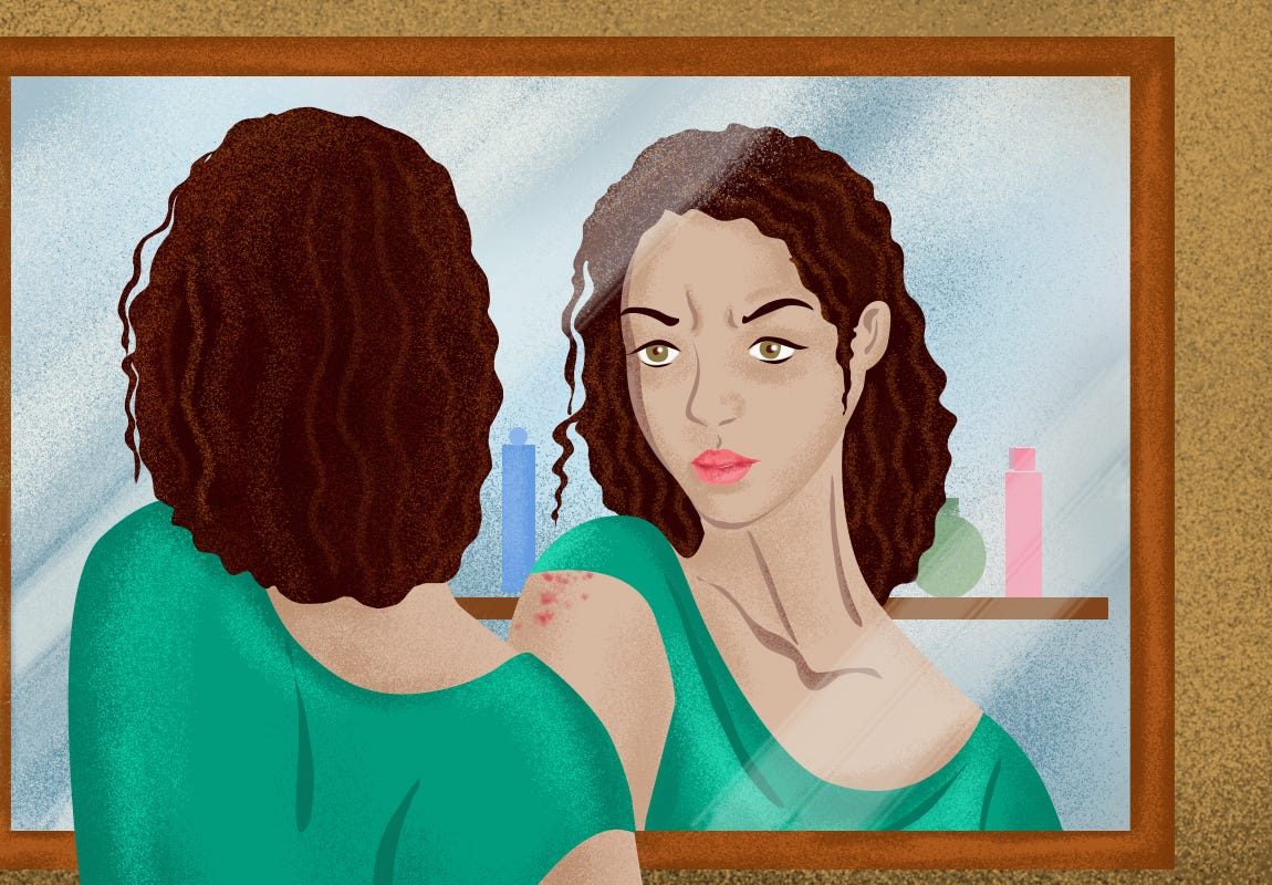 Body dysmorphic disorder The Scando Review