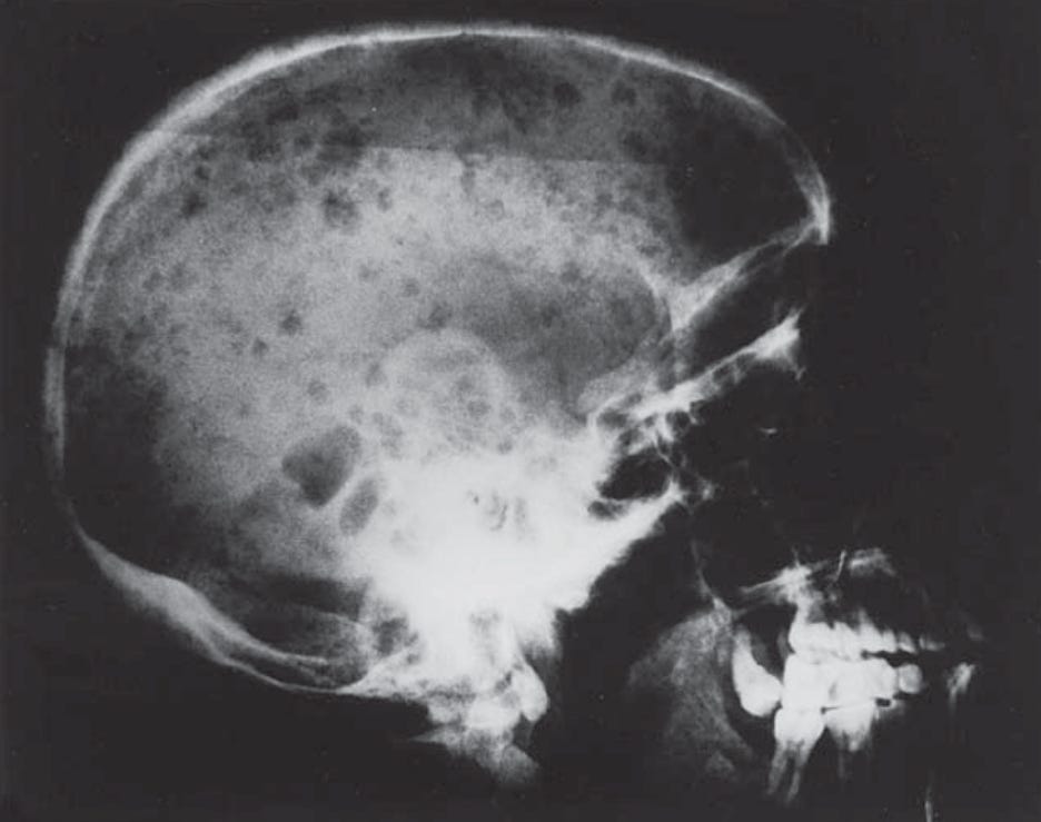 Vacina da dengue aprovada! Into Health