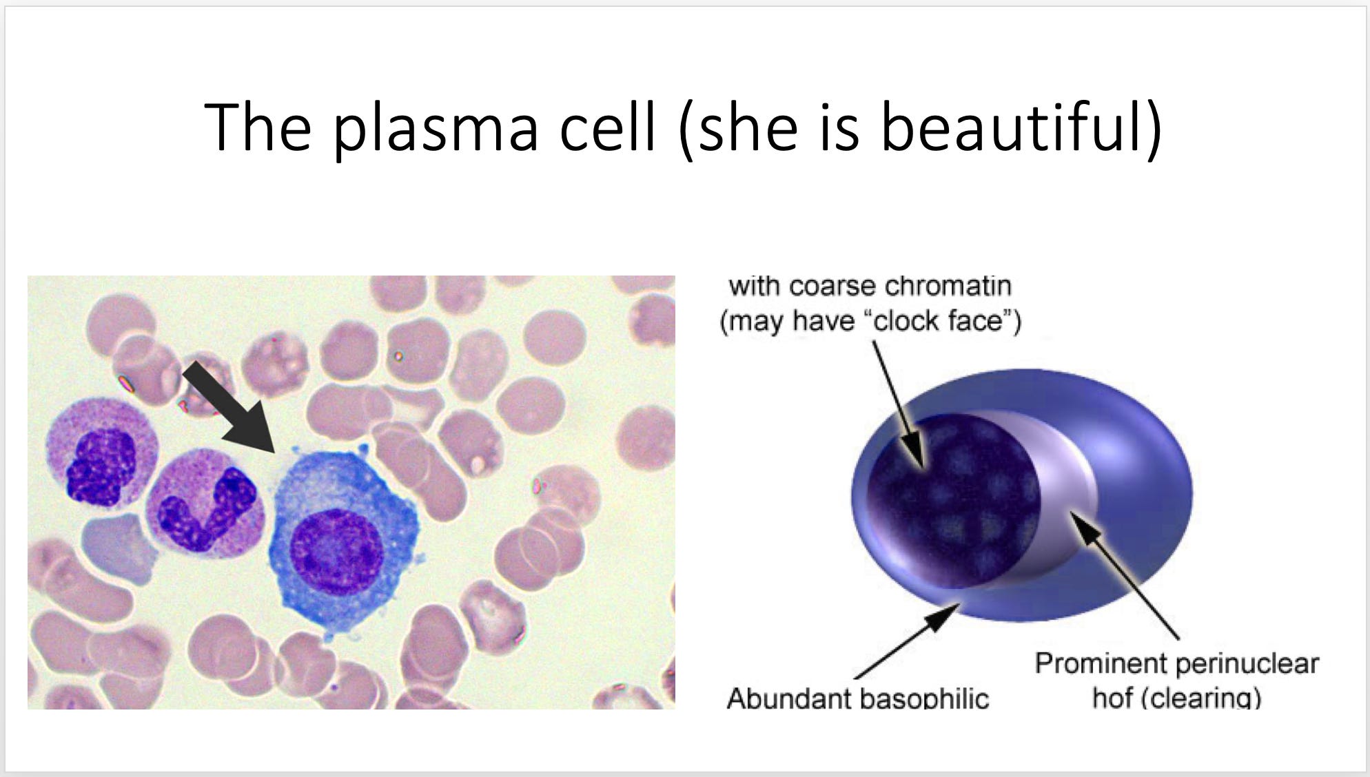 Learn monoclonal gammophaties 