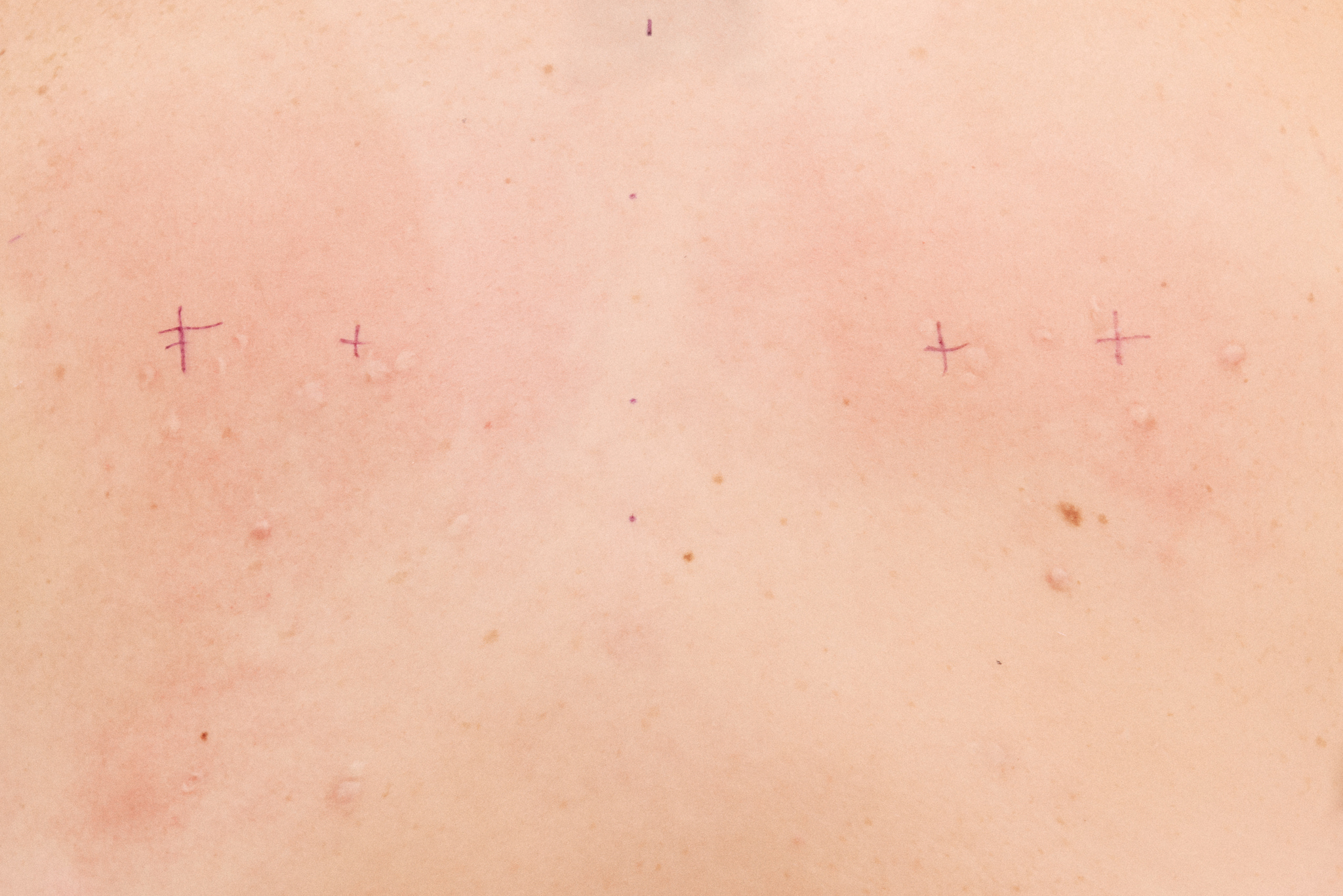 Getting Hooked on the Weird and Wonderful World of Body Suspension