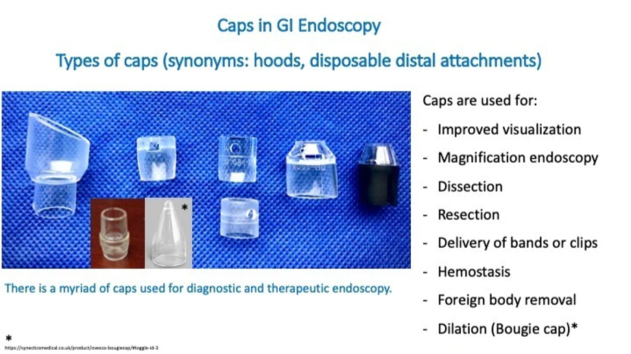 Endoscopic Removal of Esophageal Foreign Bodies Using the Tripod Grasper