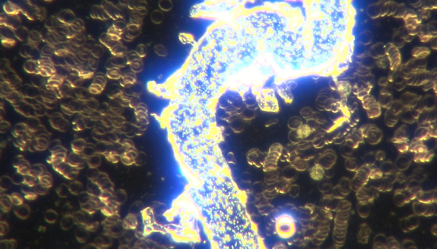 Plaquex Effects On Live Blood Oxidative Stress Affected By Self Assembled Nanotechnology