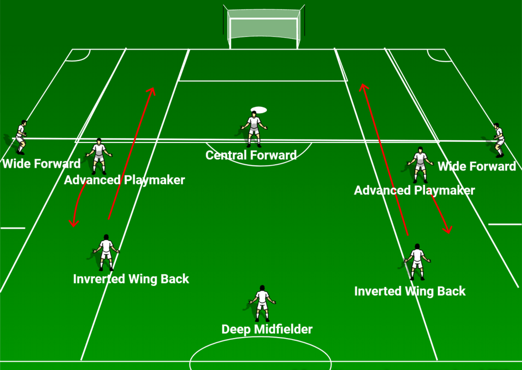 The Inverted WingBack A Comprehensive Guide