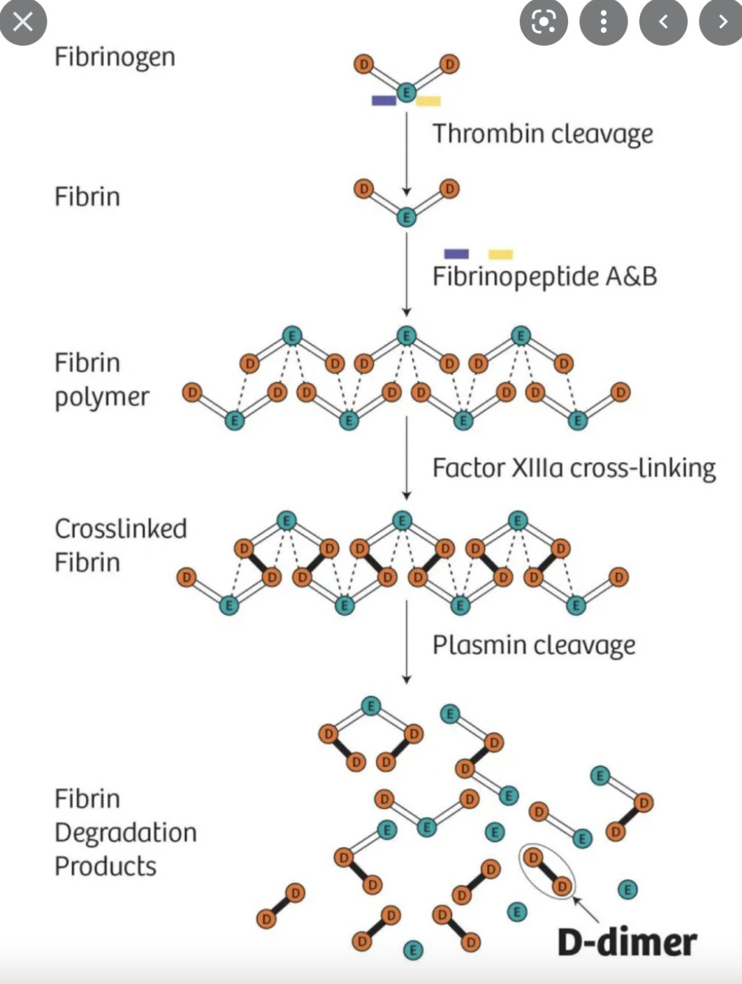 D-dimer and fibrinogen - by Aaron Goodman 