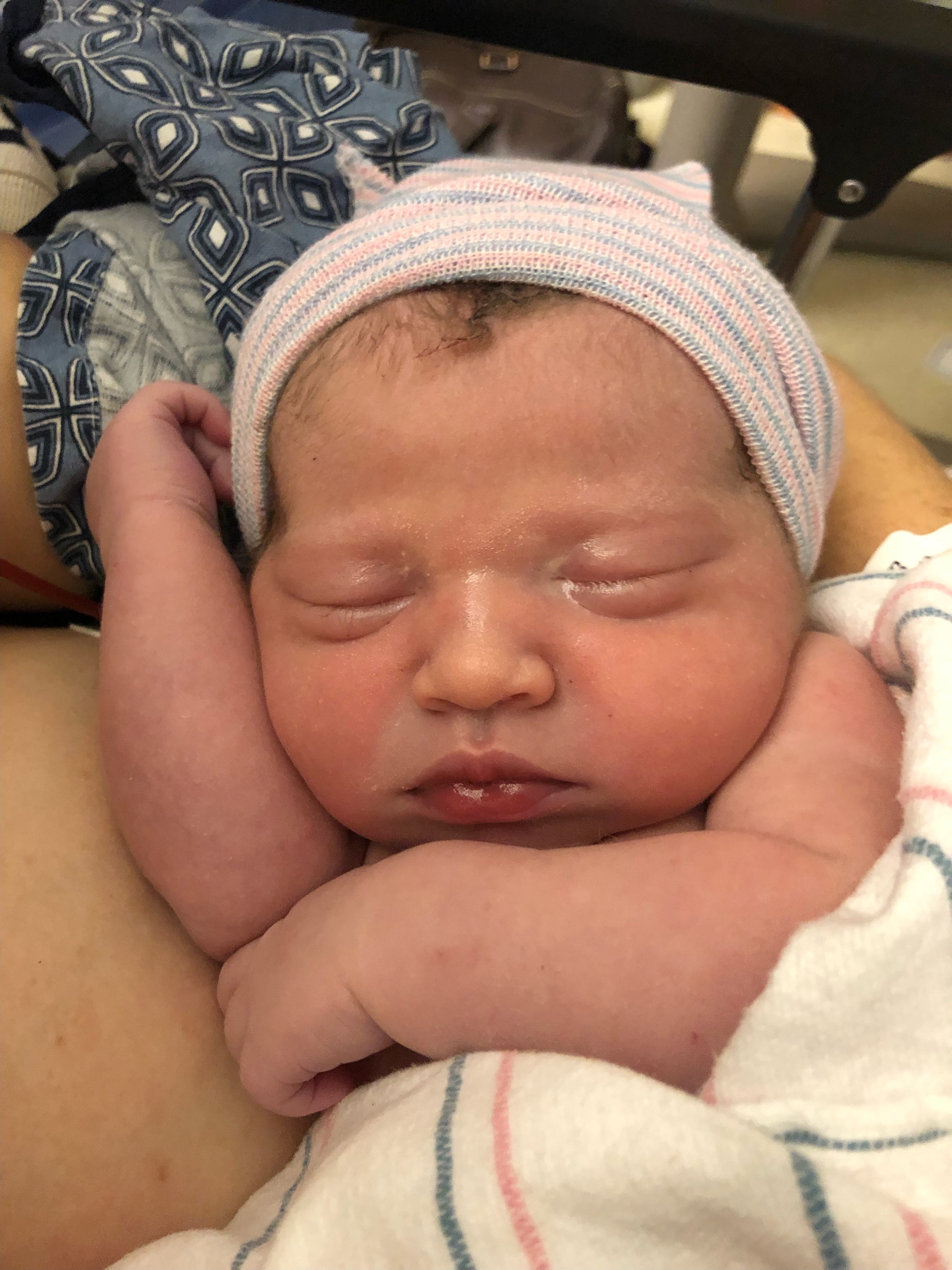 Baby puffy under clearance eyes