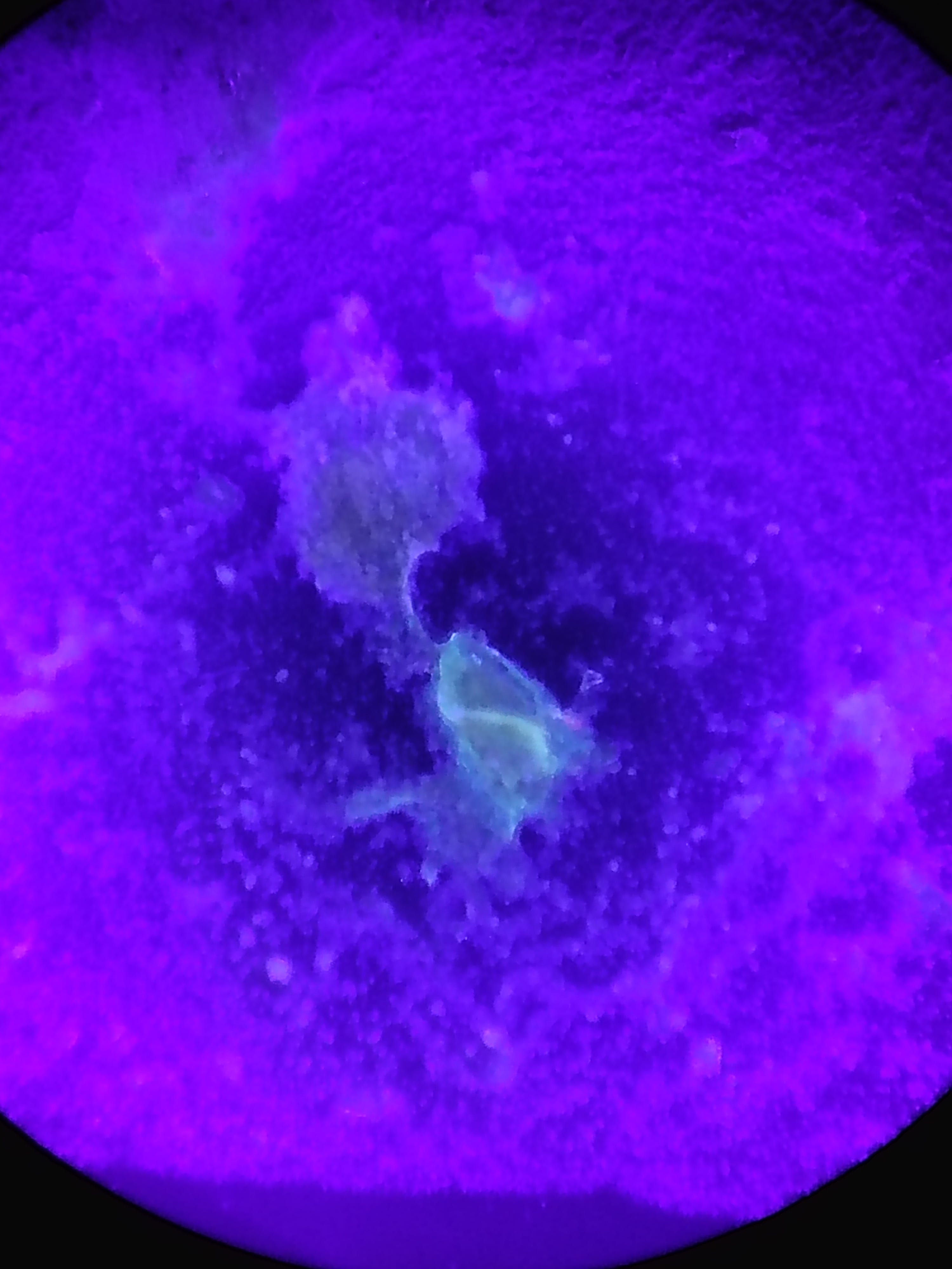 Stool sample shows UV reactive material and Qdots.