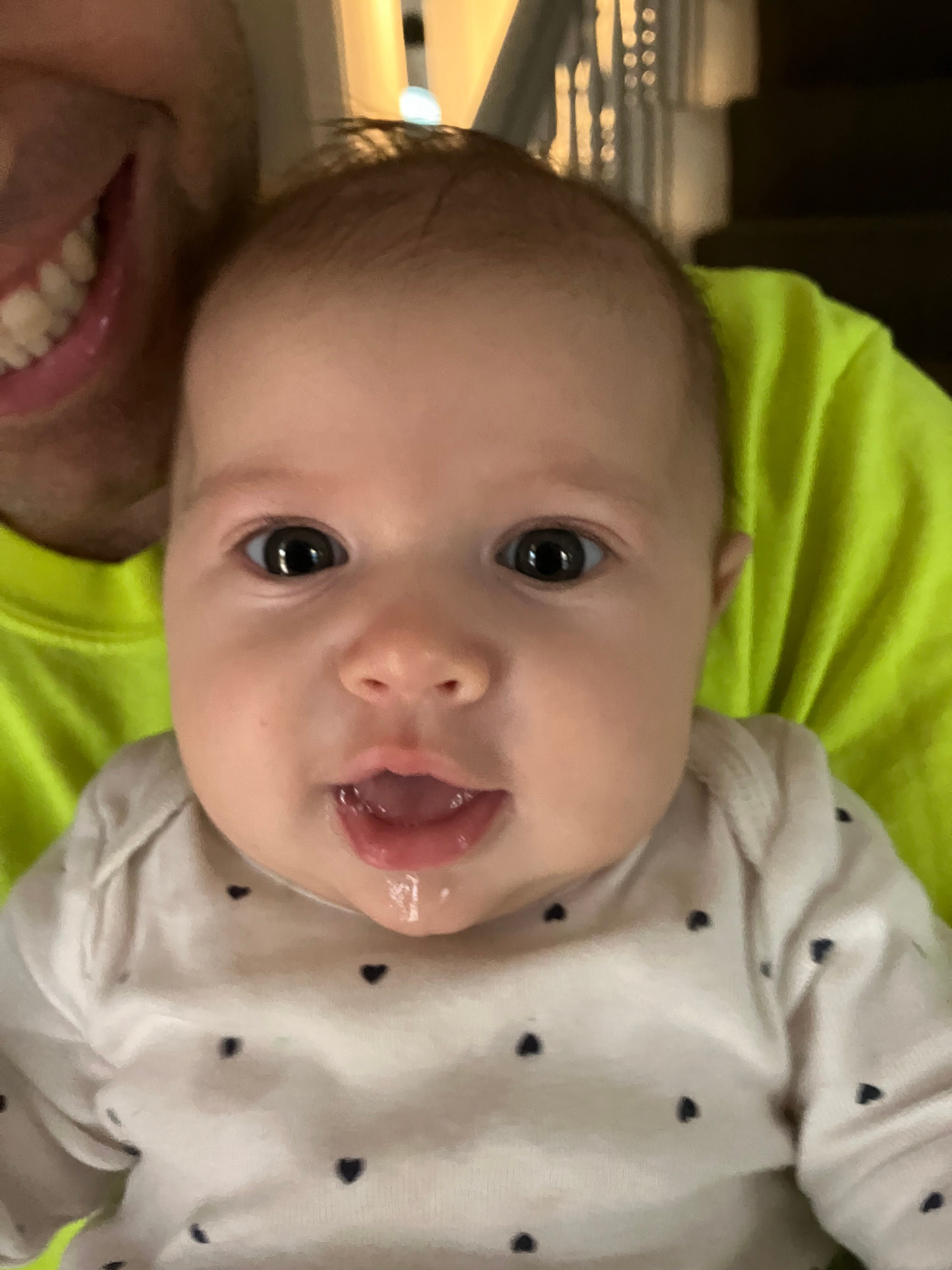 Pediatric Pearls Infant's Eye Part 1 Red Spots, Puffy Eyes, Big Eyes