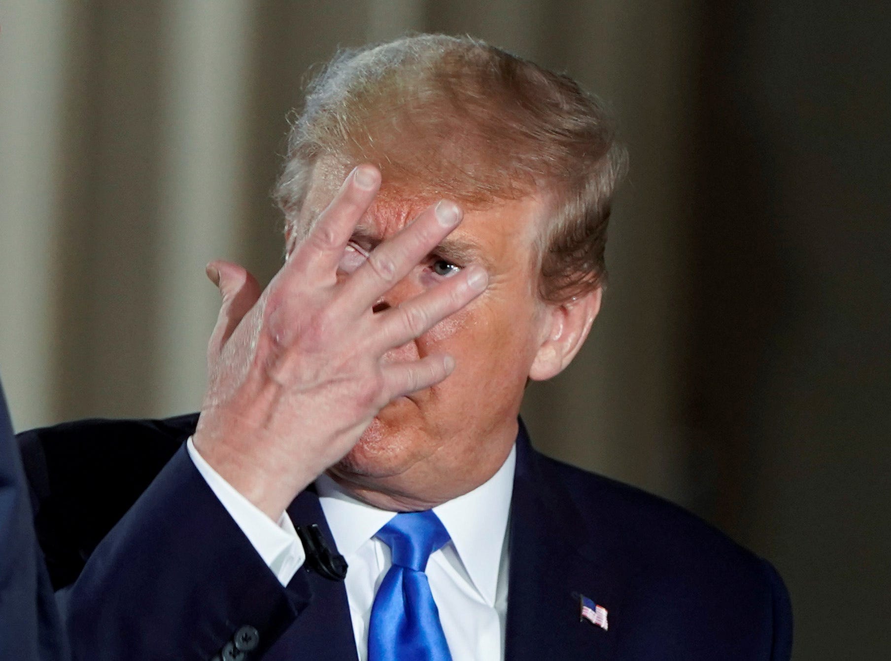 Trump Can No Longer Hide His Cognitive Issues