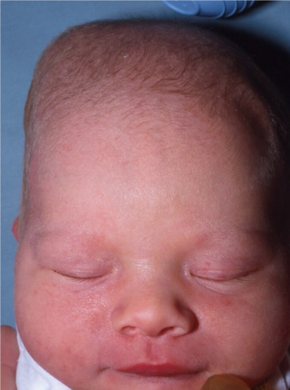 Pediatric Pearls Infant's Head Bumps, Lumps and Soft Spots