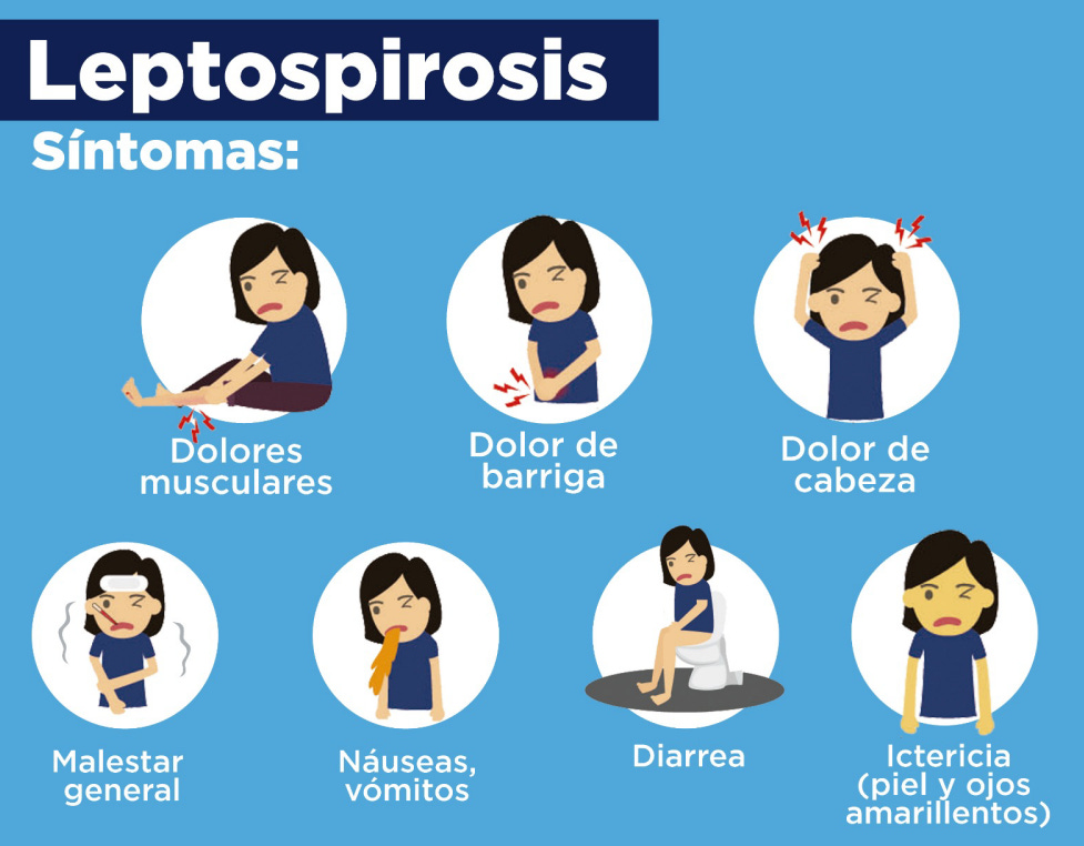 Peru reports 3,590 leptospirosis cases through March 23