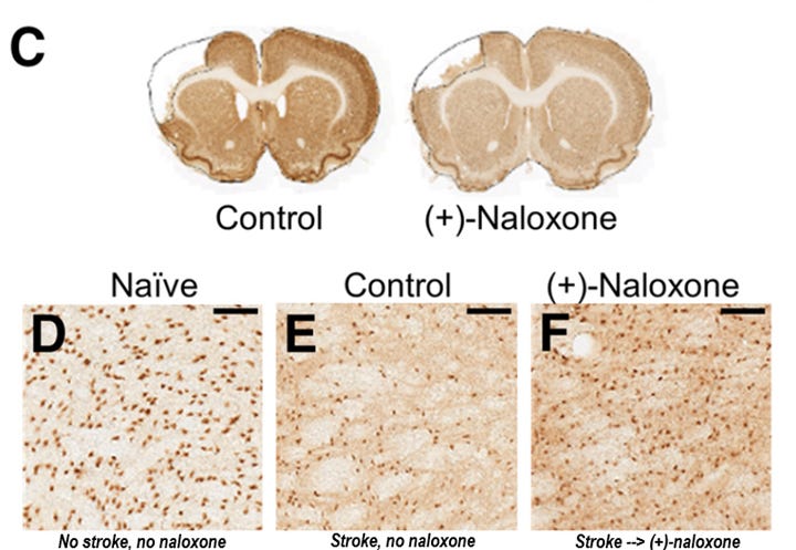 Lessons from low-dose naltrexone as a glial modulator to treat ... - Naltrexone Glp-1 Agonist Interactions With Antidepressants