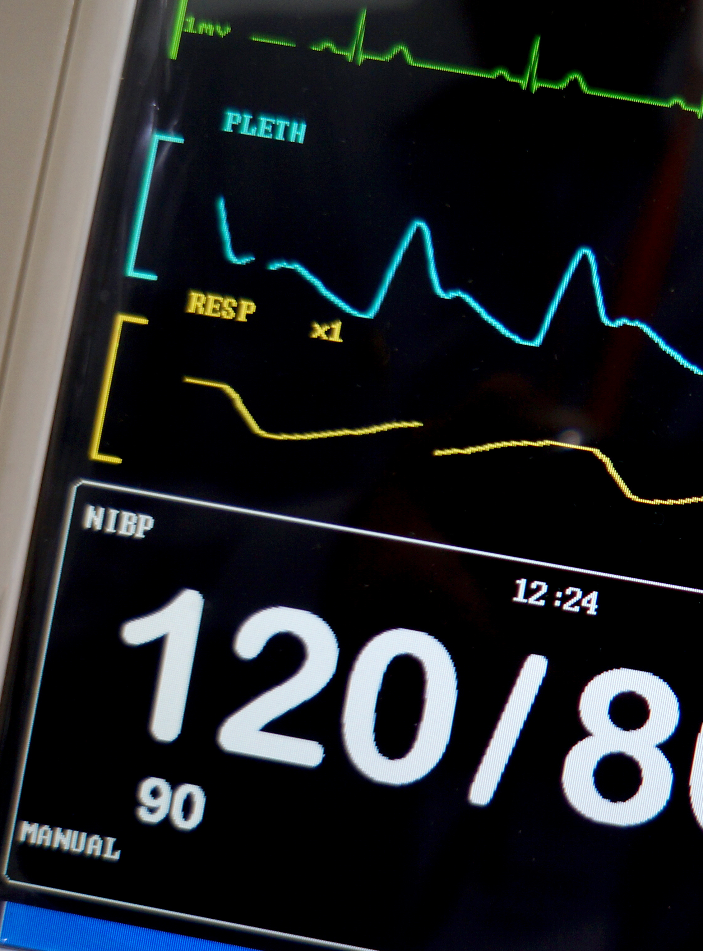 What's the ideal blood pressure target after ischemic stroke?