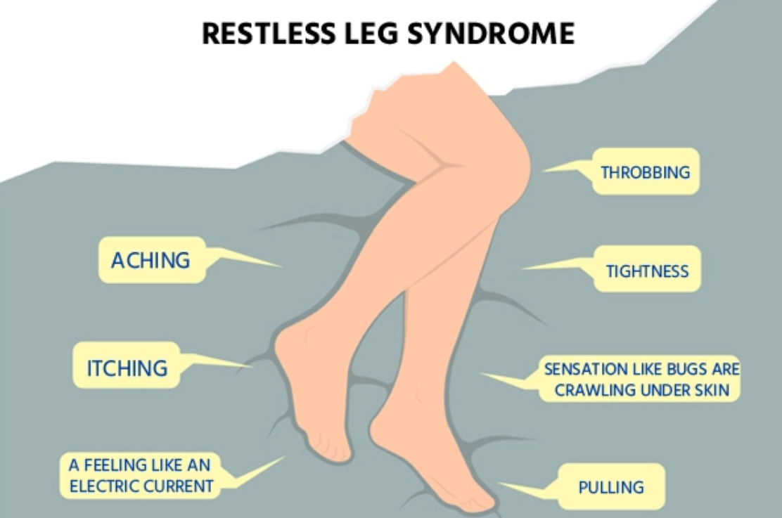 Q&A 82: dopamine agonists for restless legs syndrome - a no-no